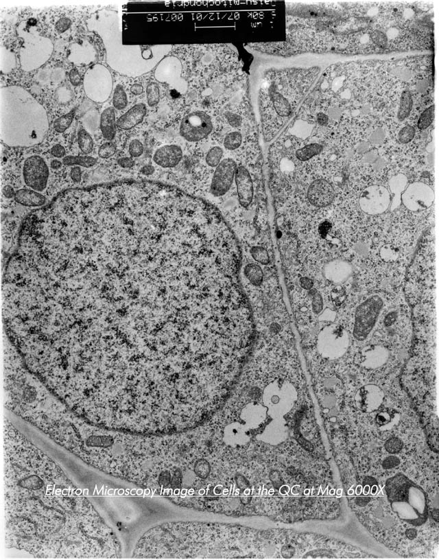 Mitochondria Ultrastructure