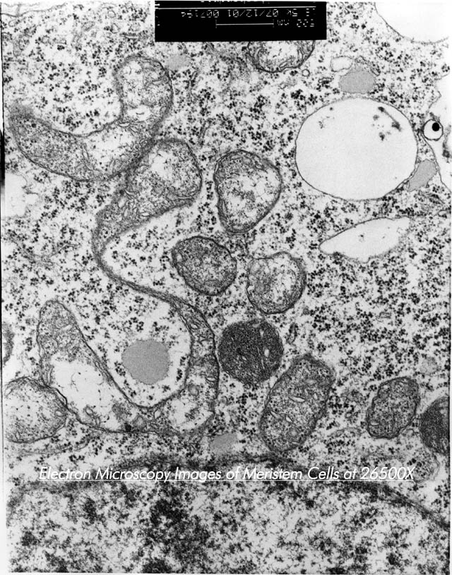 Mitochondria Ultrastructure