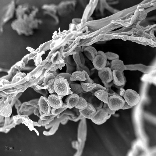 MicrobesOnDieselWaste1